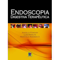 ENDOSCOPIA DIGESTIVA TERAPÊUTICA