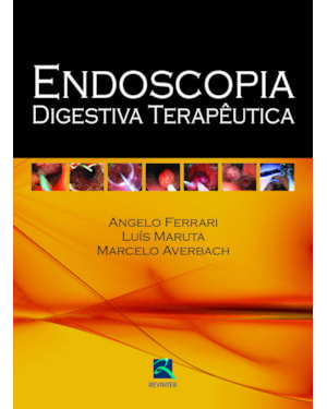 Endoscopia digestiva terapêutica