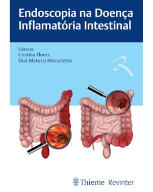 Endoscopia na doença inflamatória intestinal