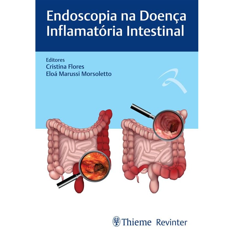 ENDOSCOPIA NA DOENÇA INFLAMATÓRIA INTESTINAL