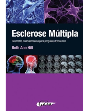 Esclerose múltipla: respostas tranquilizadoras para perguntas frequentes