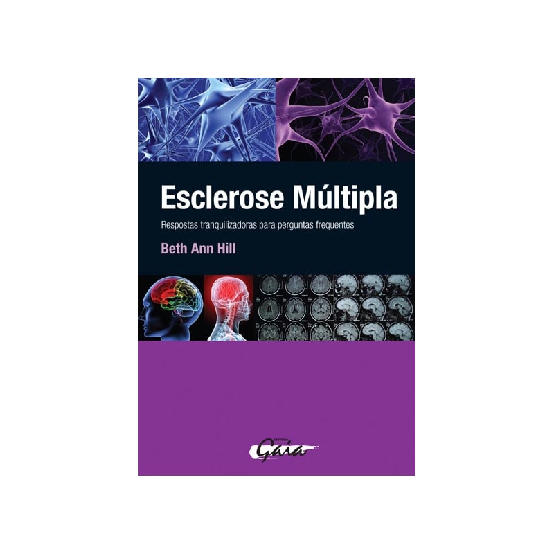 ESCLEROSE MÚLTIPLA: RESPOSTAS TRANQUILIZADORAS PARA PERGUNTAS FREQUENTES