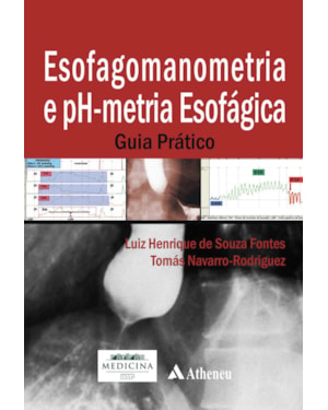 Esofagomanometria e pH-metria esofágica: guia prático