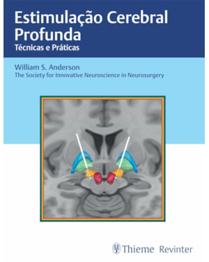Estimulação cerebral profunda: técnicas e práticas