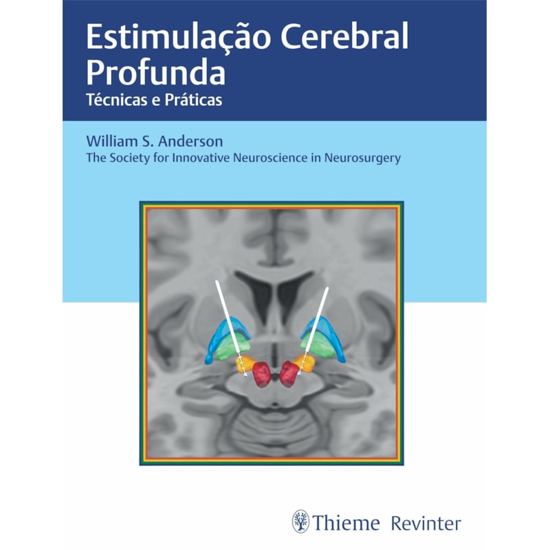 ESTIMULAÇÃO CEREBRAL PROFUNDA: TÉCNICAS E PRÁTICAS