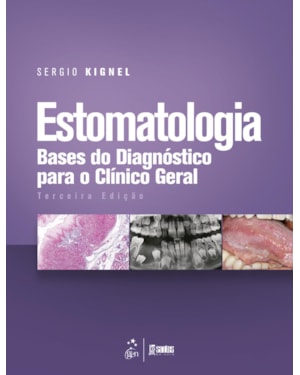 ESTOMATOLOGIA - BASES DO DIAGNÓSTICO PARA O CLÍNICO GERAL