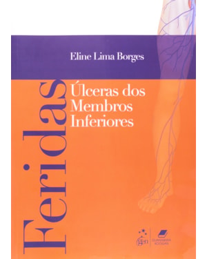 FERIDAS - ÚLCERAS DE MEMBROS INFERIORES