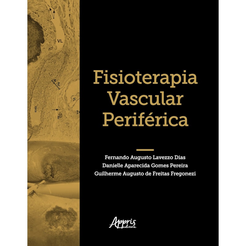 FISIOTERAPIA VASCULAR PERIFÉRICA
