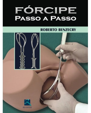 Fórcipe passo a passo