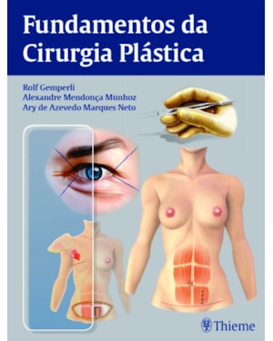 Fundamentos da cirurgia plástica