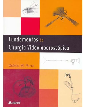 Fundamentos da cirurgia videolaparoscópica