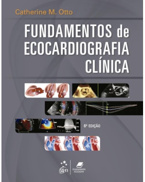 FUNDAMENTOS DE ECOCARDIOGRAFIA CLÍNICA