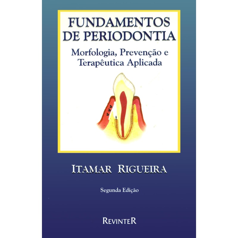 FUNDAMENTOS DE PERIODONTIA