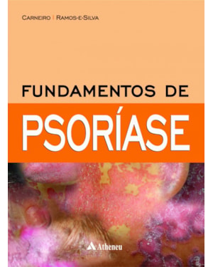 Fundamentos de psoríase