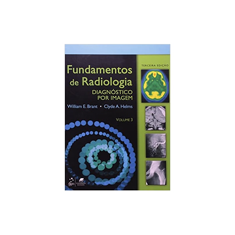FUNDAMENTOS DE RADIOLOGIA DIAGNÓSTICO POR IMAGEM