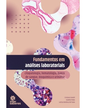 FUNDAMENTOS EM ANÁLISES LABORATORIAIS: CITOPATOLOGIA, HEMATOLOGIA, BANCO DE SANGUE, BIOQUÍMICA E URINÁLISE