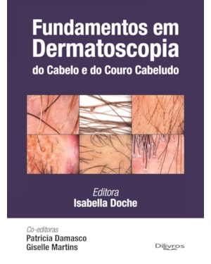 FUNDAMENTOS EM DERMATOSCOPIA DO CABELO E DO COURO CABELUDO