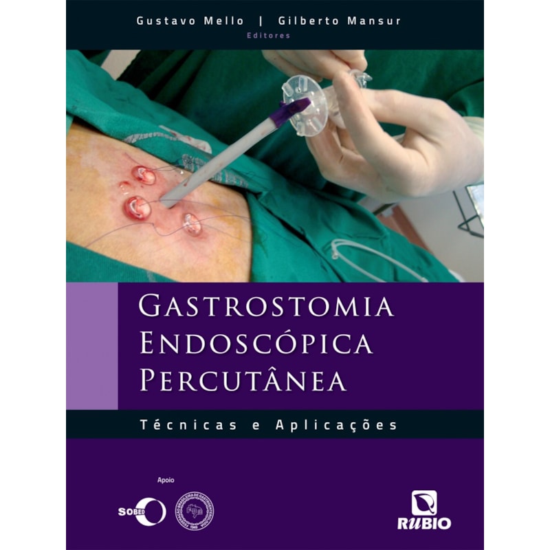 Gastrostomia endoscópica percutânea: Técnicas e aplicações