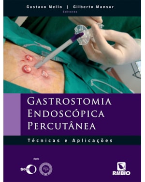 Gastrostomia endoscópica percutânea: Técnicas e aplicações
