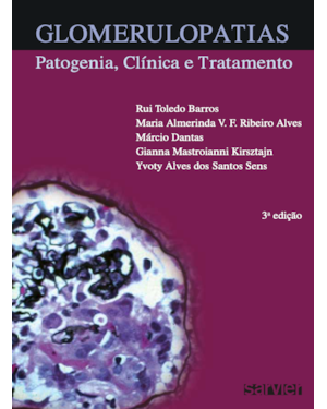 GLOMERULOPATIAS: PATOGENIA, CLÍNICA E TRATAMENTO