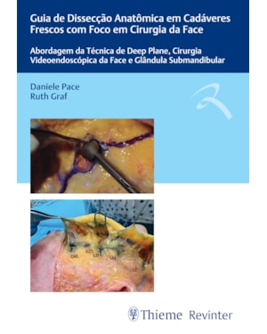 Guia de dissecção anatômica em cadáveres frescos com foco em cirurgia da face: abordagem da técnica de deep plane, cirurgia videoendoscópica da face e glândula submandibular