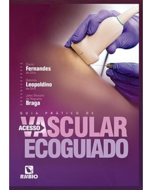 Guia prático de acesso vascular ecoguiado