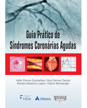 Guia prático de síndromes coronárias agudas