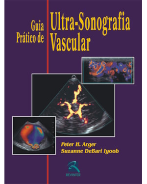 Guia prático de ultra-sonografia vascular
