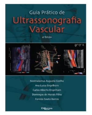 GUIA PRATICO DE ULTRASSONOGRAFIA VASCULAR