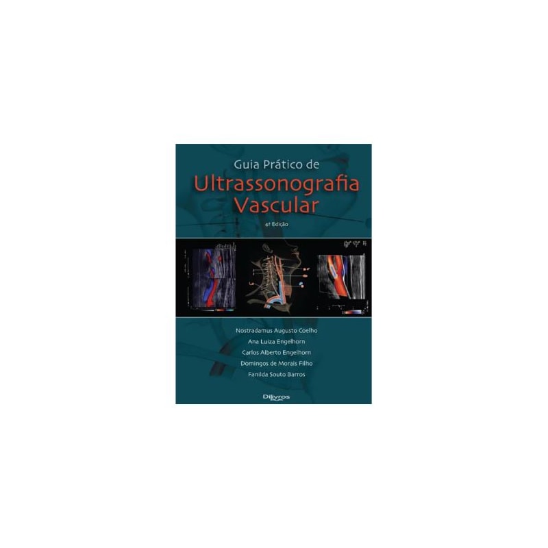 GUIA PRATICO DE ULTRASSONOGRAFIA VASCULAR