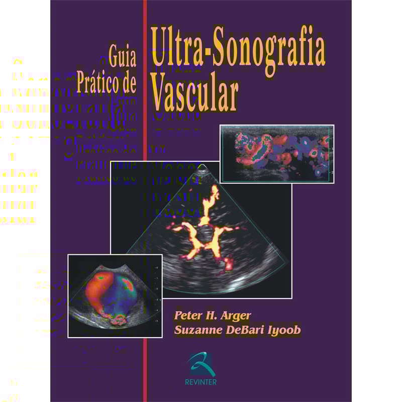 GUIA PRÁTICO DE ULTRASSONOGRAFIA VASCULAR