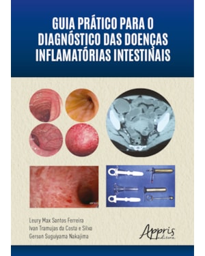 GUIA PRÁTICO PARA O DIAGNÓSTICO DAS DOENÇAS INFLAMATÓRIAS INTESTINAIS