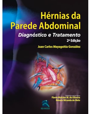 Hérnias da parede abdominal: diagnóstico e tratamento