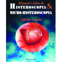 HISTEROSCOPIA E MICRO-HISTEROSCOPIA: MANUAL E ATLAS