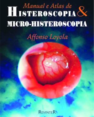 HISTEROSCOPIA E MICRO-HISTEROSCOPIA: MANUAL E ATLAS