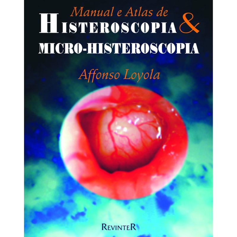 HISTEROSCOPIA E MICRO-HISTEROSCOPIA: MANUAL E ATLAS