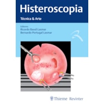 HISTEROSCOPIA: TÉCNICA & ARTE