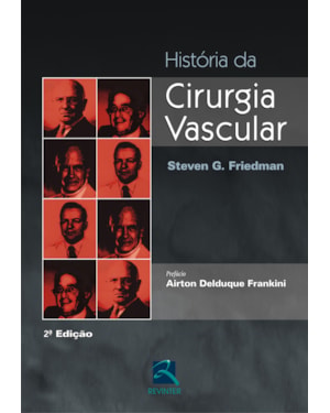 História da cirurgia vascular