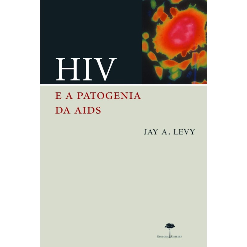 HIV E A PATOGENIA DA AIDS