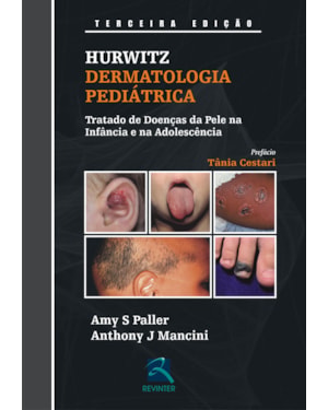 Hurwitz - Dermatologia pediátrica: tratado de doenças da pele na infância e na adolescência