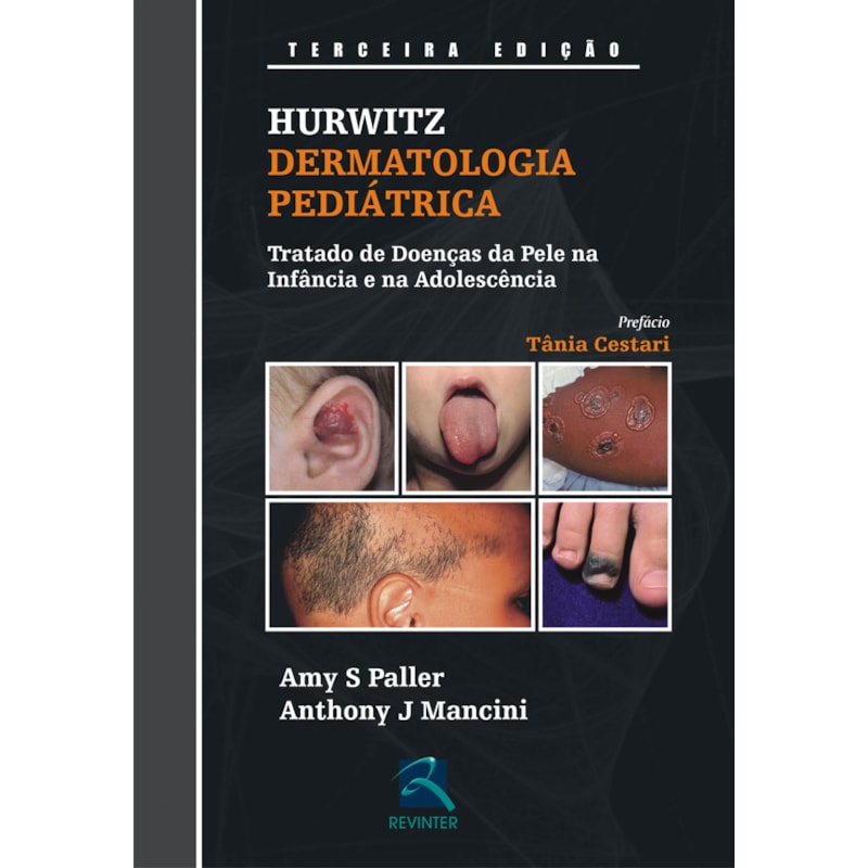 Hurwitz - Dermatologia pediátrica: tratado de doenças da pele na infância e na adolescência