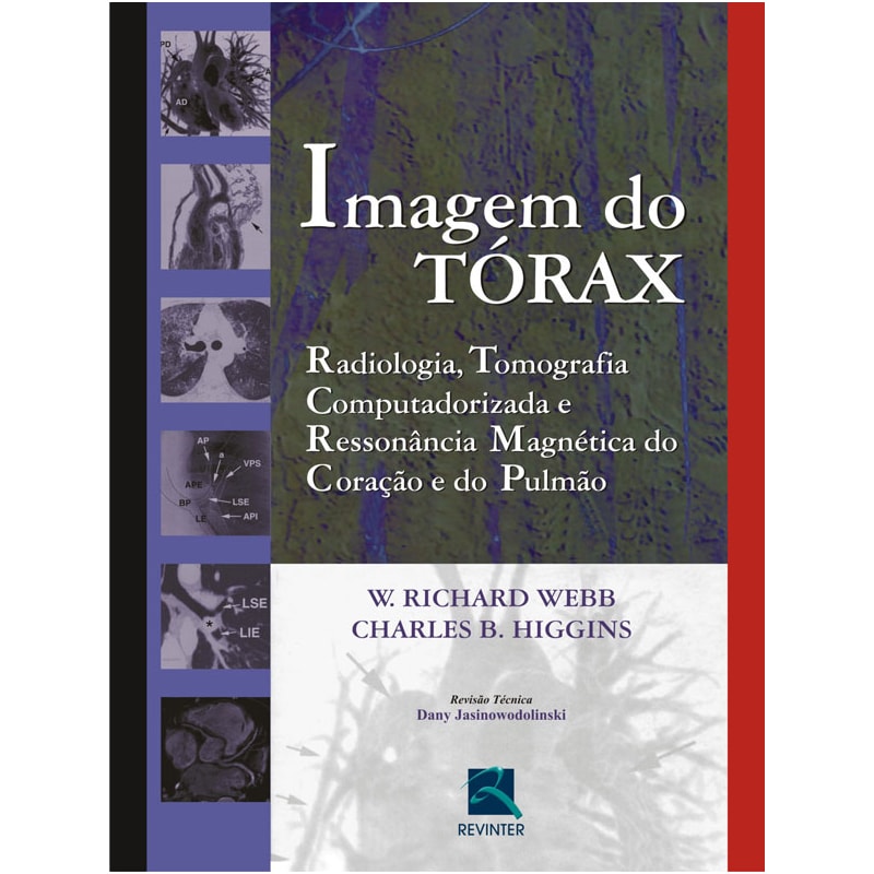 IMAGEM DO TÓRAX: RADIOLOGIA, TOMOGRAFIA COMPUTADORIZADA, E RESSONÂNCIA MAGNÉTICA DO CORAÇÃO E DO PULMÃO