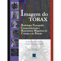 Imagem do tórax: radiologia, tomografia computadorizada e ressonância magnética do coração e do pulmão