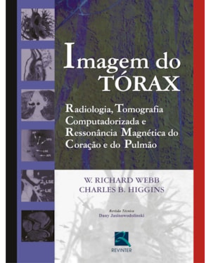 Imagem do tórax: radiologia, tomografia computadorizada e ressonância magnética do coração e do pulmão