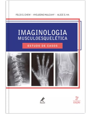 Imaginologia musculoesquelética: Estudo de casos