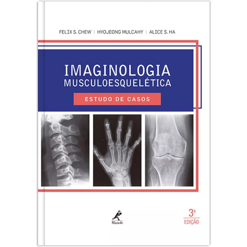 IMAGINOLOGIA MUSCULOESQUELÉTICA: ESTUDO DE CASOS