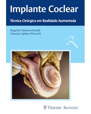 Implante coclear: técnicas cirúrgica em realidade aumentada