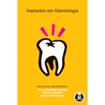 IMPLANTES EM ODONTOLOGIA