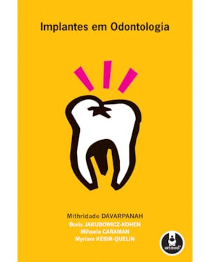 IMPLANTES EM ODONTOLOGIA