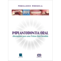 Implantodontia oral: alternativas para uma prótese bem-sucedida